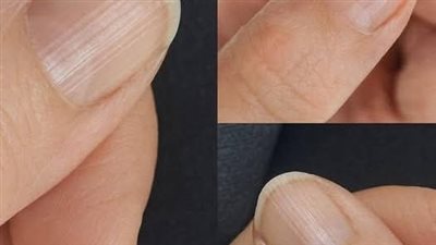 article
